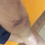 IMG_20170715_203149_707.jpg