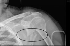 1 omuzişaretli.jpg 1 omuzişaretli.jpg